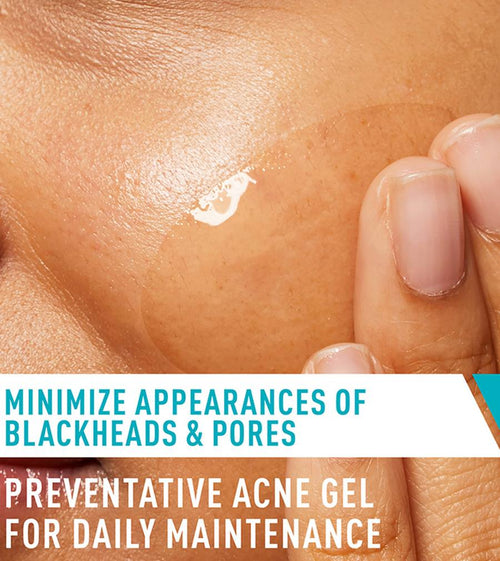 CeraVe Acne Control Gel, 2% Salicylic Acid Treatment With Glycolic Acid + Lactic Acids,